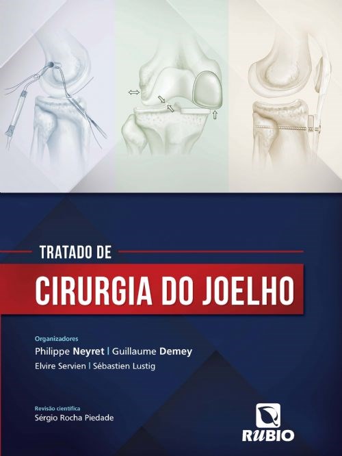 Livro Tratado de Cirurgia do Joelho