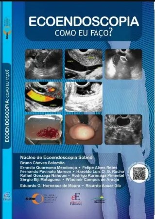 Livro Ecoendoscopia como Eu Faço