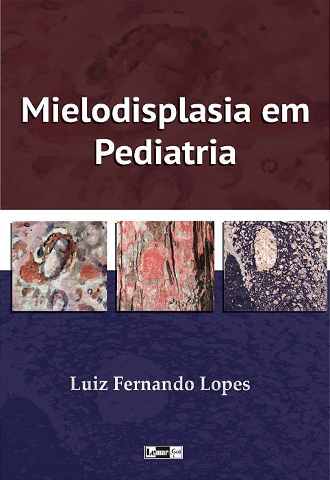 Livro Mielodisplasia Em Pediatria - Lopes