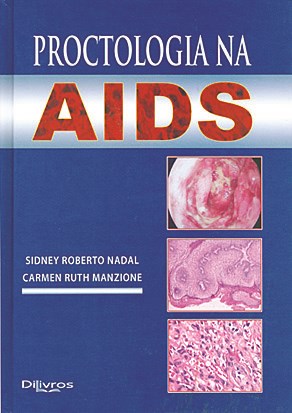 Livro Proctologia Na Aids - Nadal/mazione