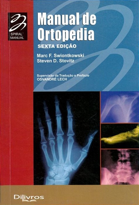 Manual de Ortopedia *** Swiontkowski