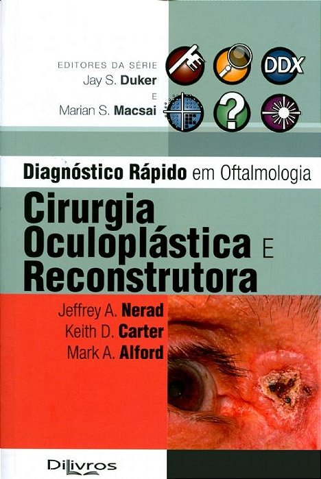 Livro Cirurgia Oculoplástica e Reconstrutora - Nerad
