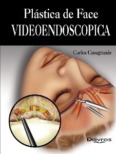 Livro Plástica de Face Videoendoscópica  Casagrande