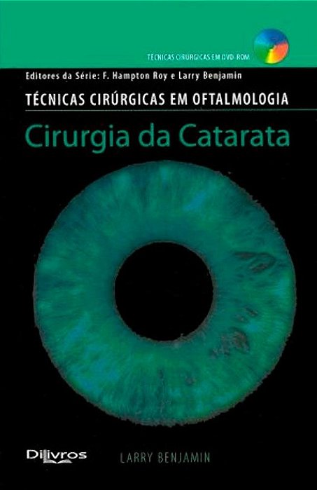 Livro Cirurgia da Catarata - Benjamin - Dilivros