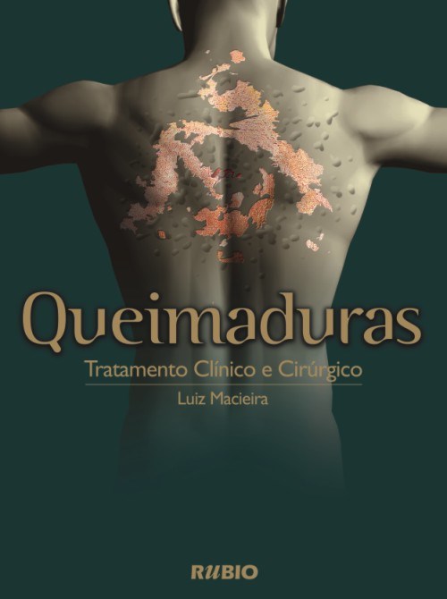 Livro Queimaduras:  Tratamento Clínico e Cirúrgico  Macieira