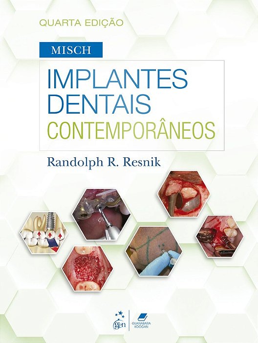 Livro Misch Implantes Dentais Contemporâneos: Resnik  Guanabara