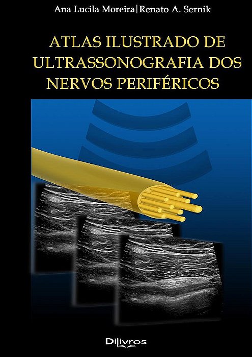 Livro Atlas Ilustrado de Ultrassonografia dos Nervos Periféricos