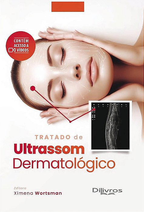 Livro Tratado de Ultrassom Dermatológico Wortsman