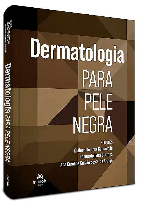 Livro Dermatologia para a Pele Negra - Conceição