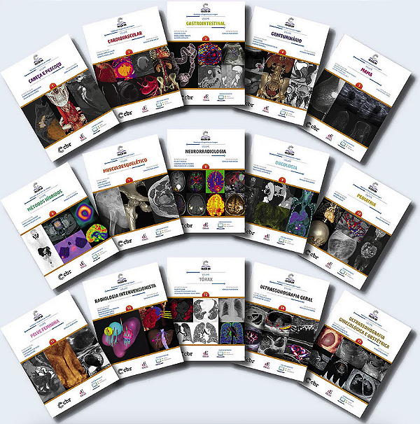 Livros Coleção CBR 15 Volumes Colégio Brasileiro de Radiologia