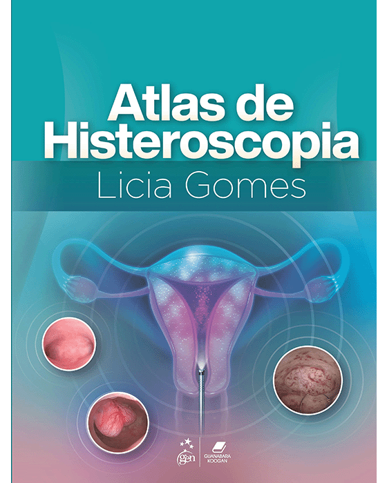 Livro Atlas de Histeroscopia  Gomes