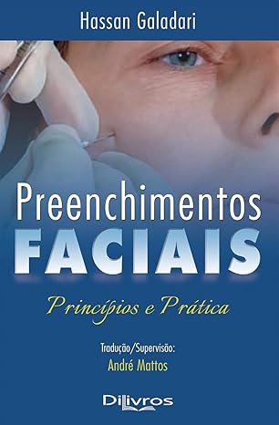 Livro Preenchimentos Faciais Princípios e Prática  Galadari