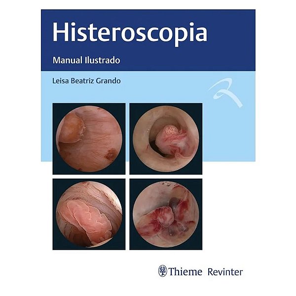Livro Histeroscopia: Manual Ilustrado  Grando