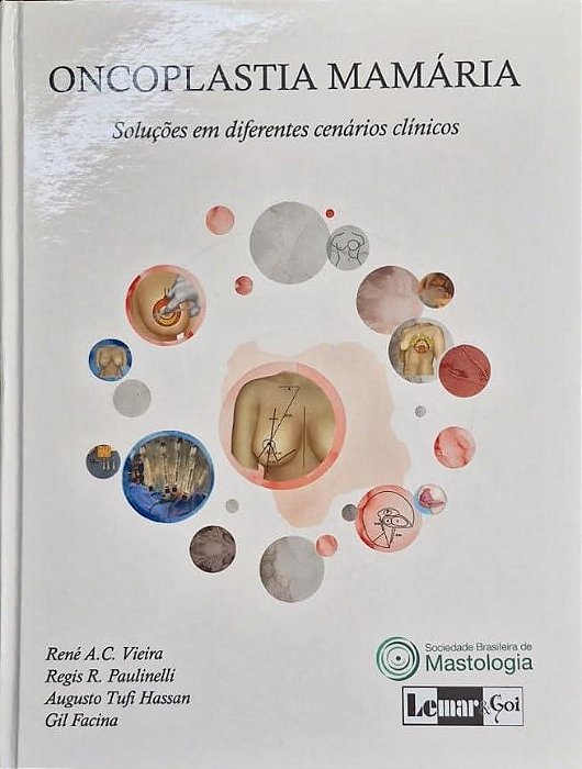 Livro Oncoplastia Mamária Soluções em Diferentes Cenários Clinicos