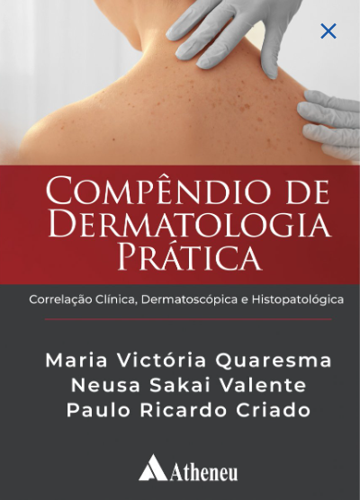 Livro Compêndio de Dermatologia Prática