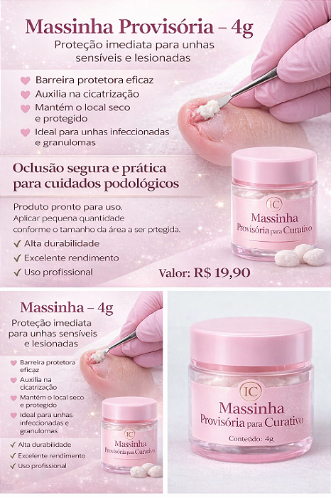 Massinha Provisória para Curativo – 4g Uso profissional podológico
