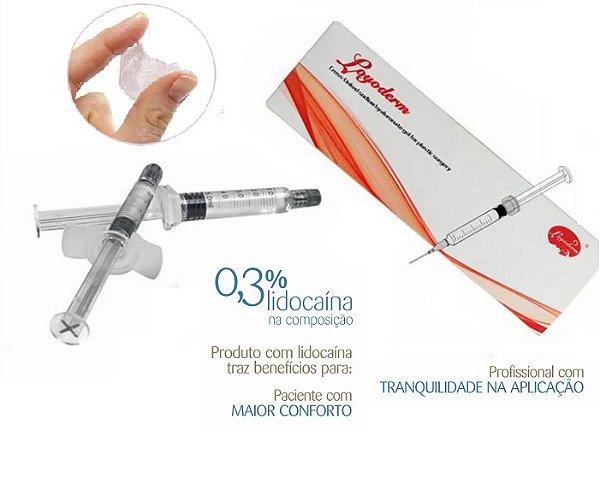 Preenchedor Ácido Hialurônico Injetável 5ml Reticulado Subskin Lido - Loyoderm + Microcânula de brinde