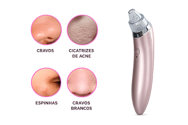 Removedor de Cravos Portátil para Limpeza Facial
