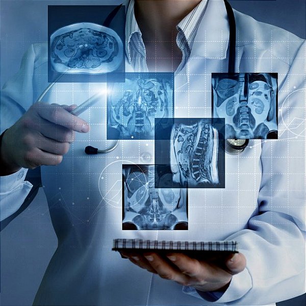 Radiologia: a importância da detecção precoce e dos avanços tecnológicos na medicina