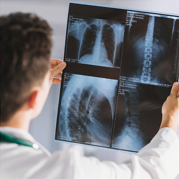 Radiologia: Importância, subáreas e especialidade médica