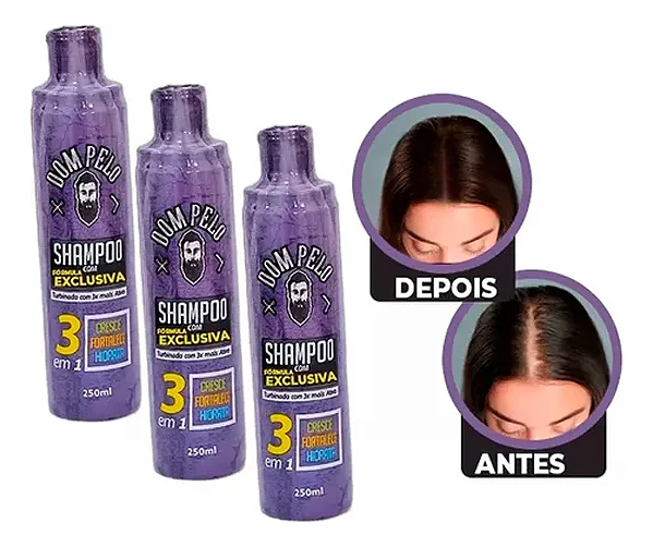 Kit 3 Shampoo Minoxidil Fortificante 3 Em 1 - Dom Pelo 250ml
