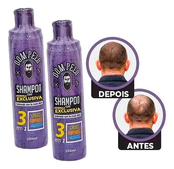 Kit 12 Shampoo Minoxidil Fortificante 3 Em 1 - Dom Pelo 250ml