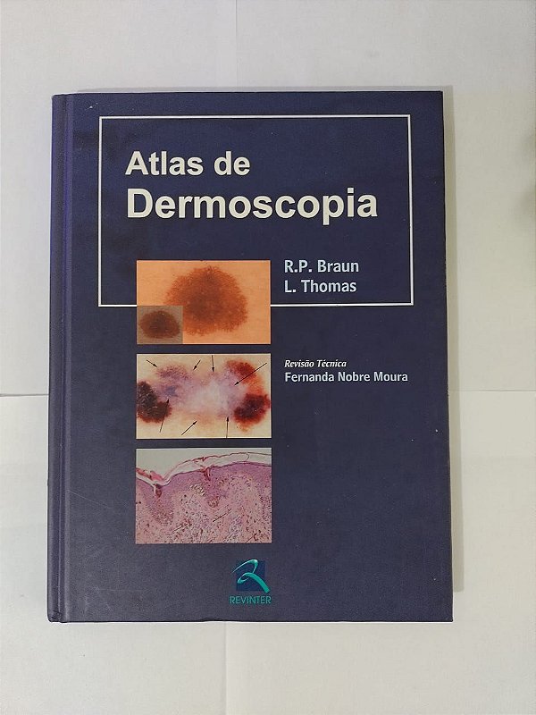Atlas de Dermoscopia - R. P. Braun e L. Thomas