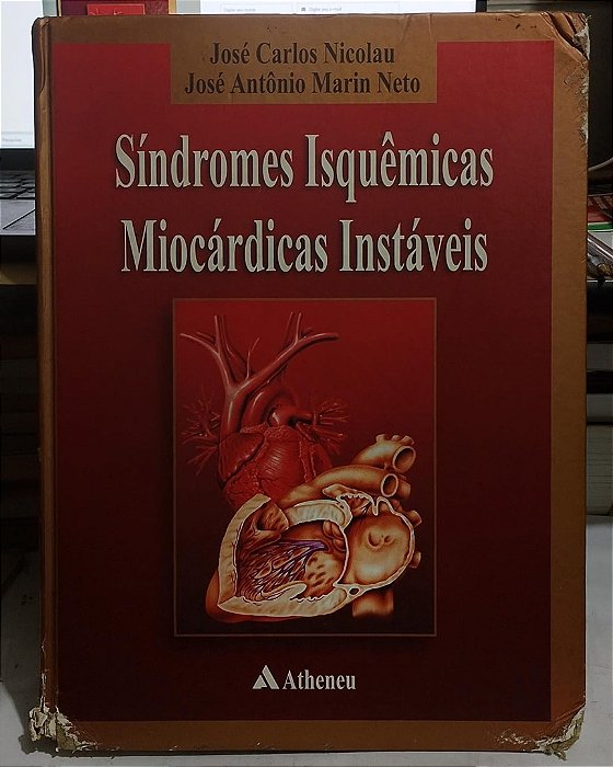 Síndromes Isquêmicas Miocárdicas Instáveis - José Carlos Nicolau (marcas)