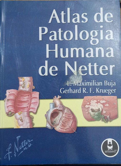 Atlas de Patologia Humana de Netter - L. Maximilian Buja