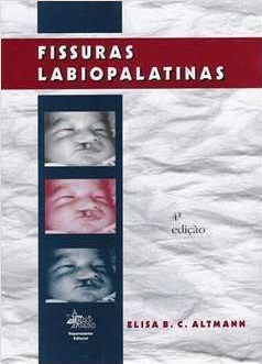 Fissuras Labiopalatinas - Elisa B. C. Altmann