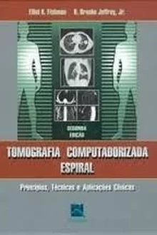 Tomografia Computadorizada Espiral - Princípios, Técnicas e Aplicações - Elliot K. Fishman