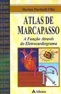 Atlas de Marcapasso a Função Através do Eletrocardiograma - Martino Martinelli Filho