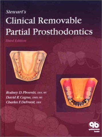 Stewart's Clinical Removable Partial Prosthodontics - Rodney D. Phoenix