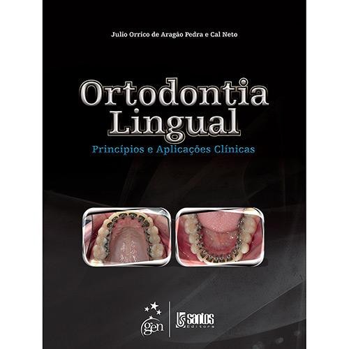 Ortodontia Lingual: Princípios E Aplicações Clínicas Novo