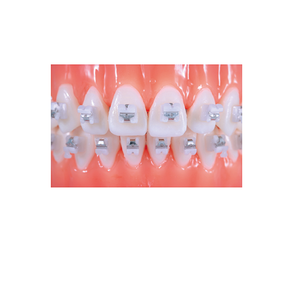 Braquete Estético Ceramic Roth 022 - WTB