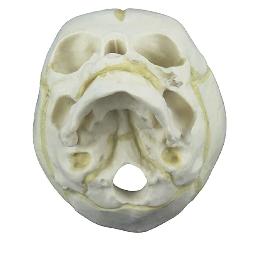 CRÂNIO HUMANO FETAL - SD5006/D - SDORF