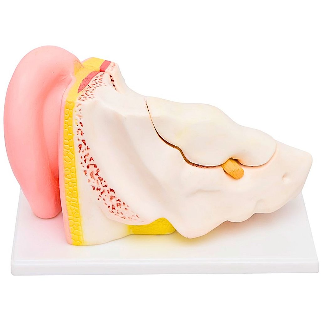OUVIDO AMPLIADO EM 5 PARTES - SD5045 - SDORF