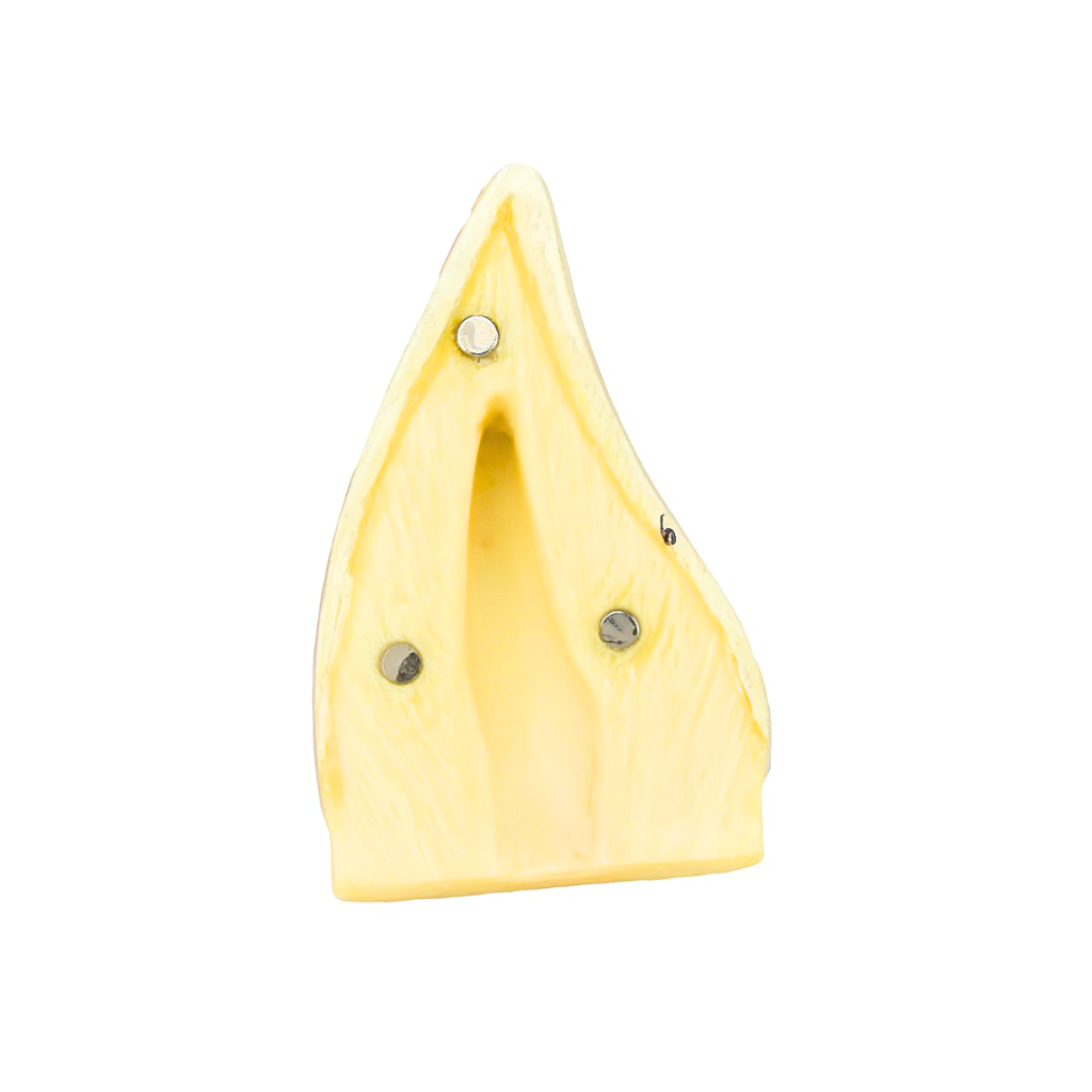 DENTE INCISIVO INFERIOR EM 2 PARTES, 8X O TAMANHO REAL APROX