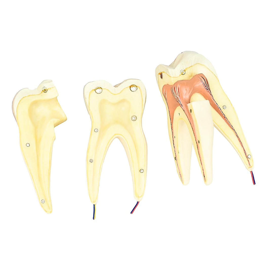 DENTE MOLAR SUPERIOR C/ RAIZ TRIPLA EM 3 PARTES, 8X O TAM. REAL