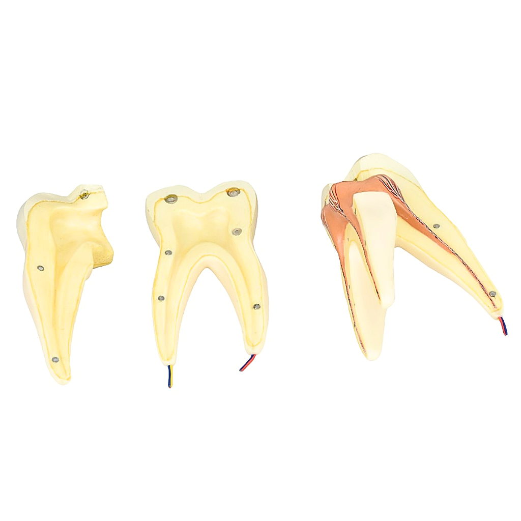 DENTE MOLAR SUPERIOR C/ RAIZ TRIPLA EM 3 PARTES, 8X O TAM. REAL