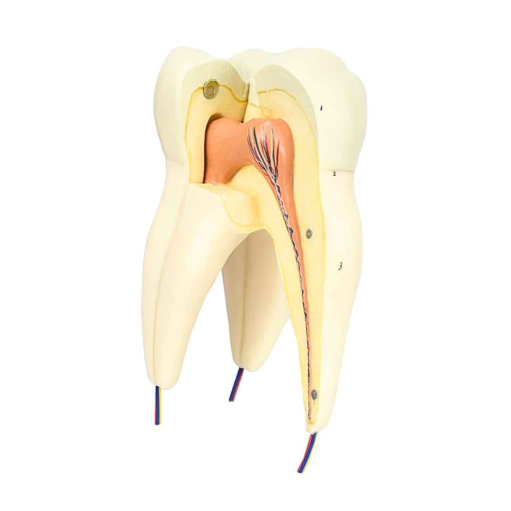 DENTE MOLAR SUPERIOR C/ RAIZ TRIPLA EM 3 PARTES, 8X O TAM. REAL