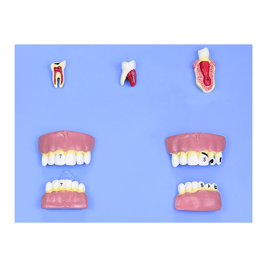 MODELO DE PATOLOGIAS DENTÁRIAS C/ 12 PARTES EM PLACA