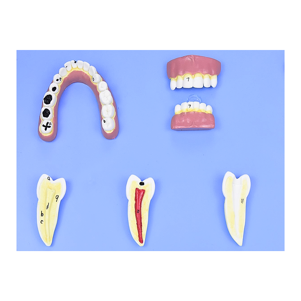 MODELO DE PATOLOGIAS DENTÁRIAS C/ 12 PARTES EM PLACA