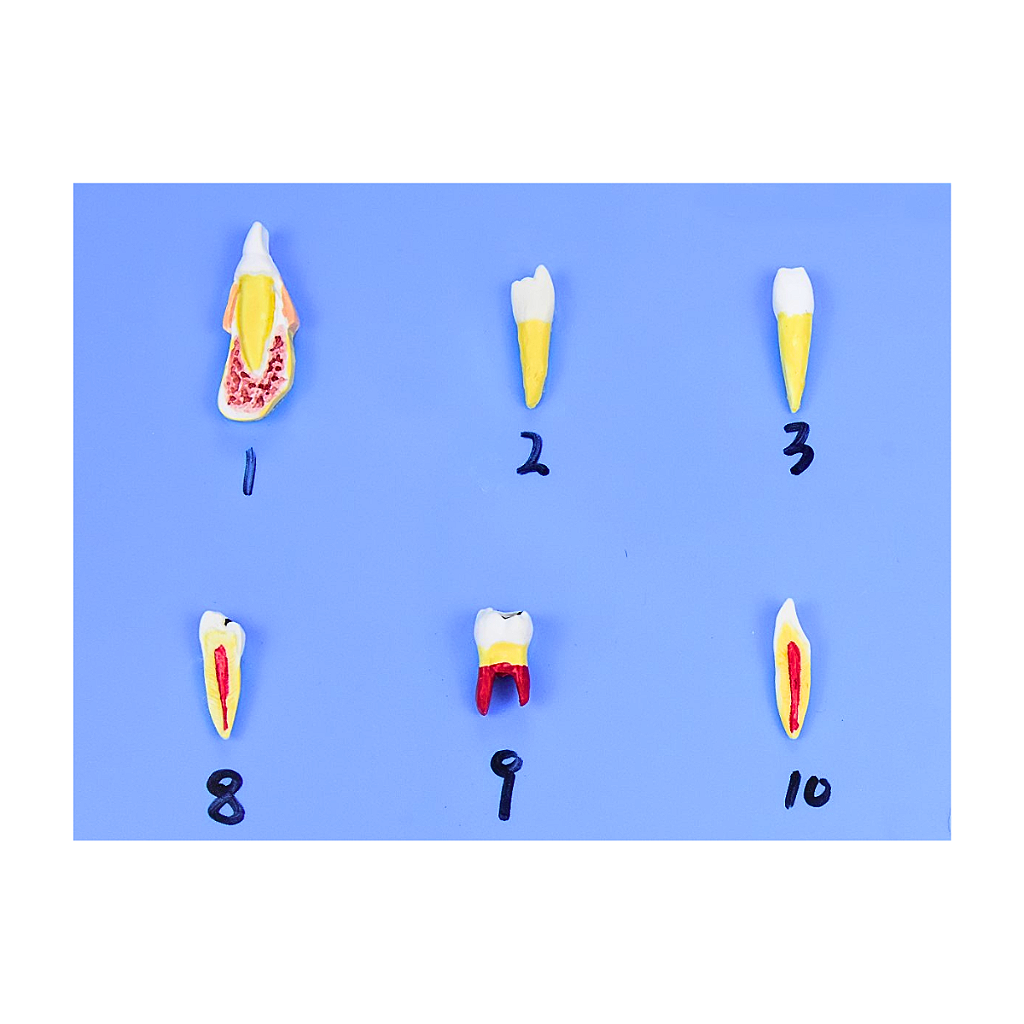 MODELO DE PATOLOGIAS DENTÁRIAS C/ 25 PARTES EM PLACA