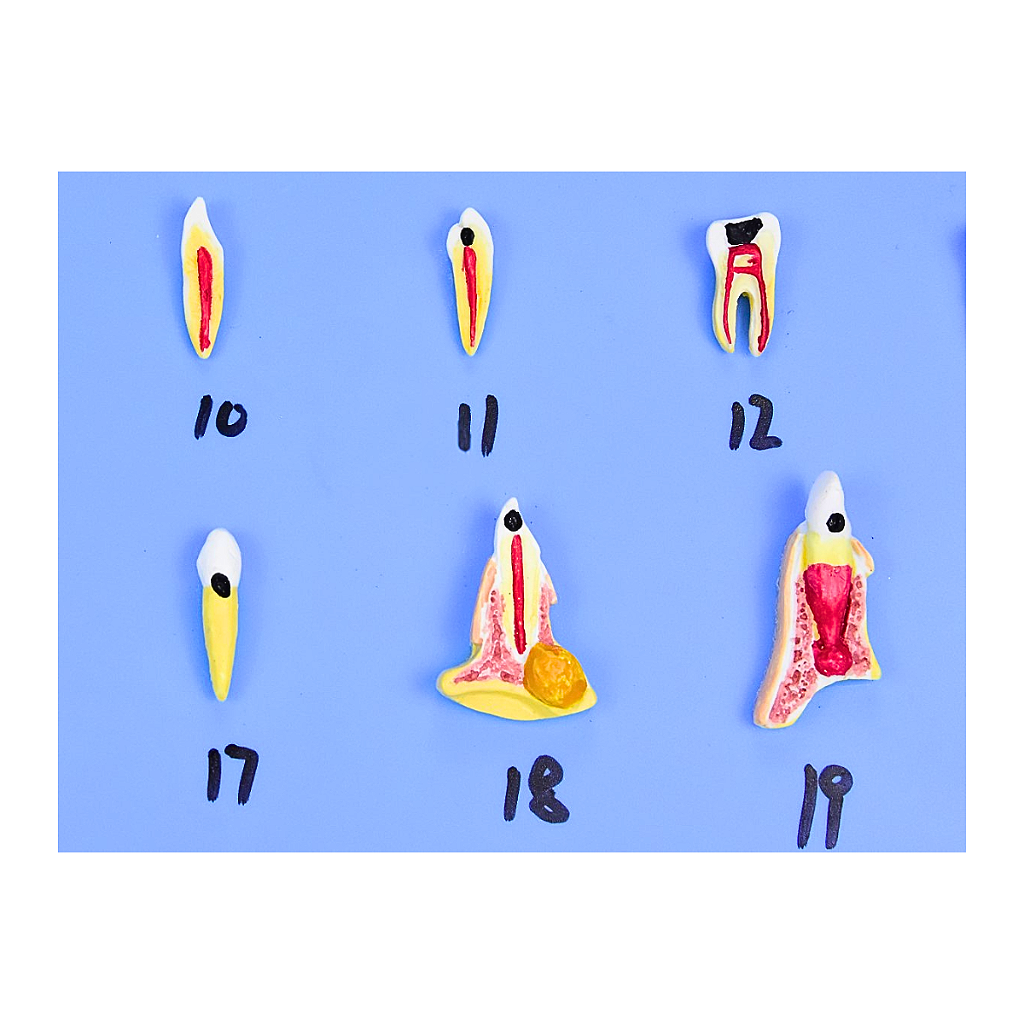 MODELO DE PATOLOGIAS DENTÁRIAS C/ 25 PARTES EM PLACA