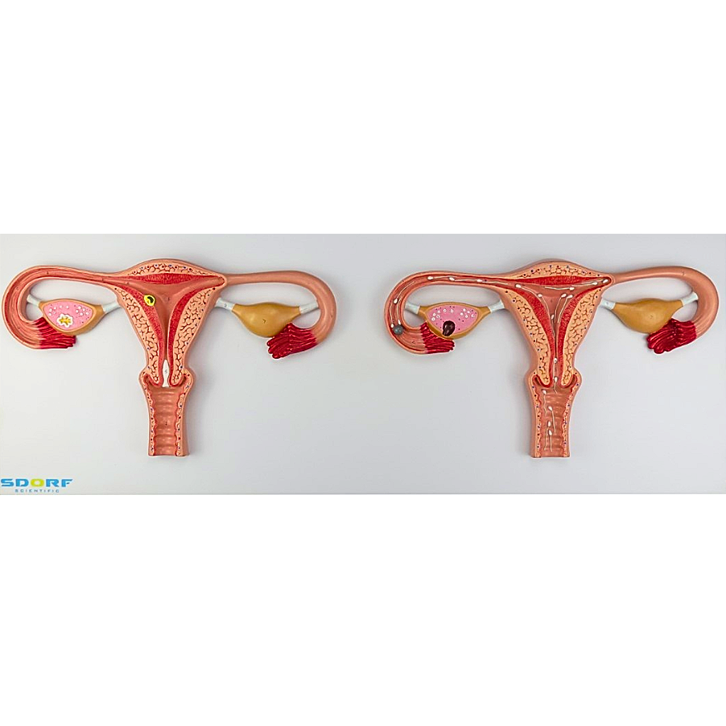 PROCESSO DE FERTILIZAÇÃO - SD5084 - SDORF