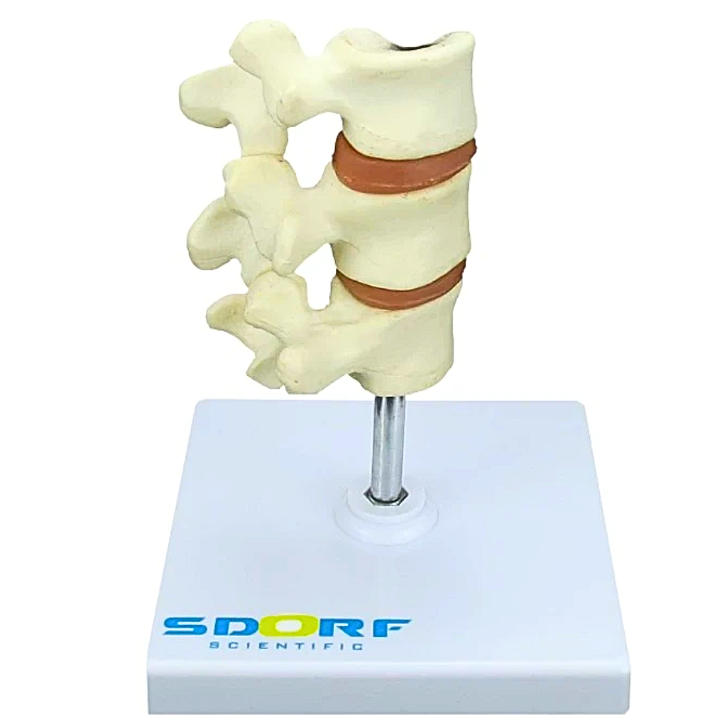 MODELO DE OSTEOPOROSE - SD5200 - SDORF