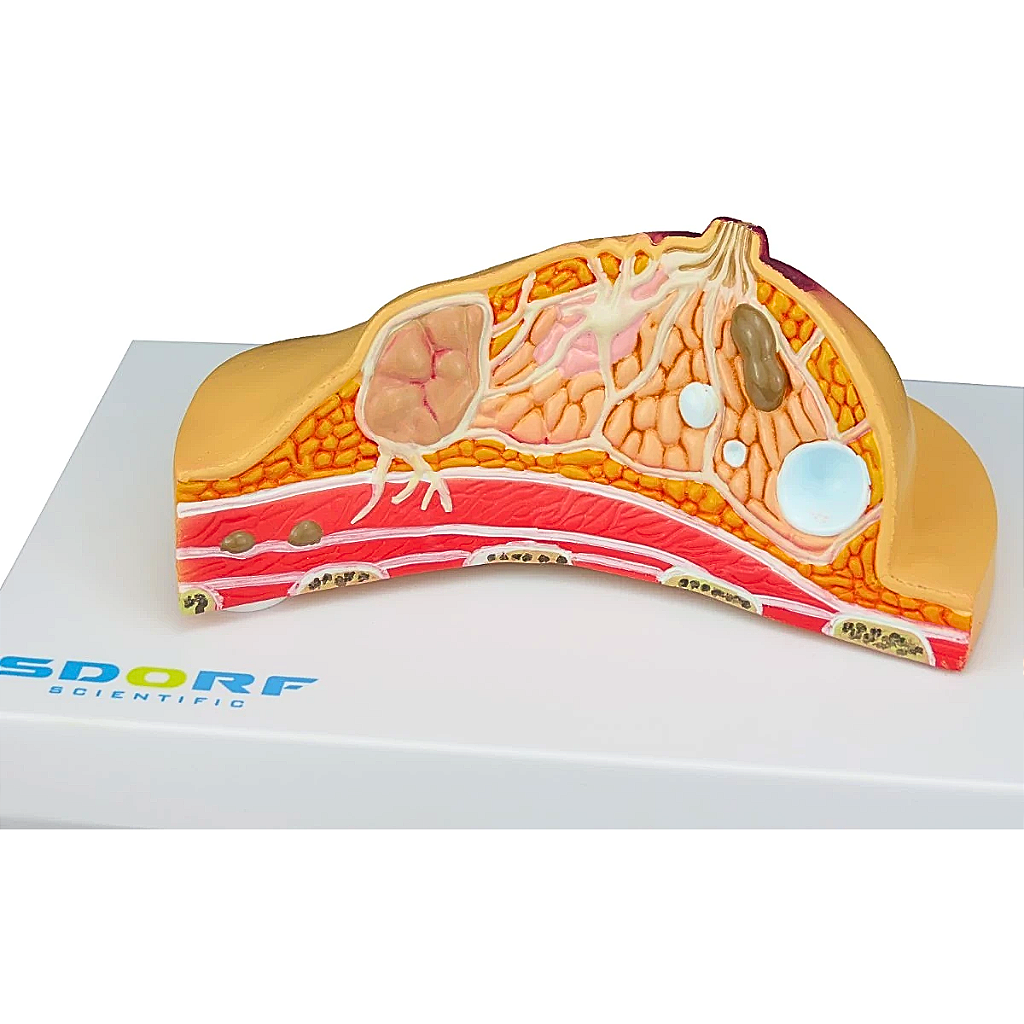 MODELO PATOLÓGICO DE MAMA - SD5209 - SDORF
