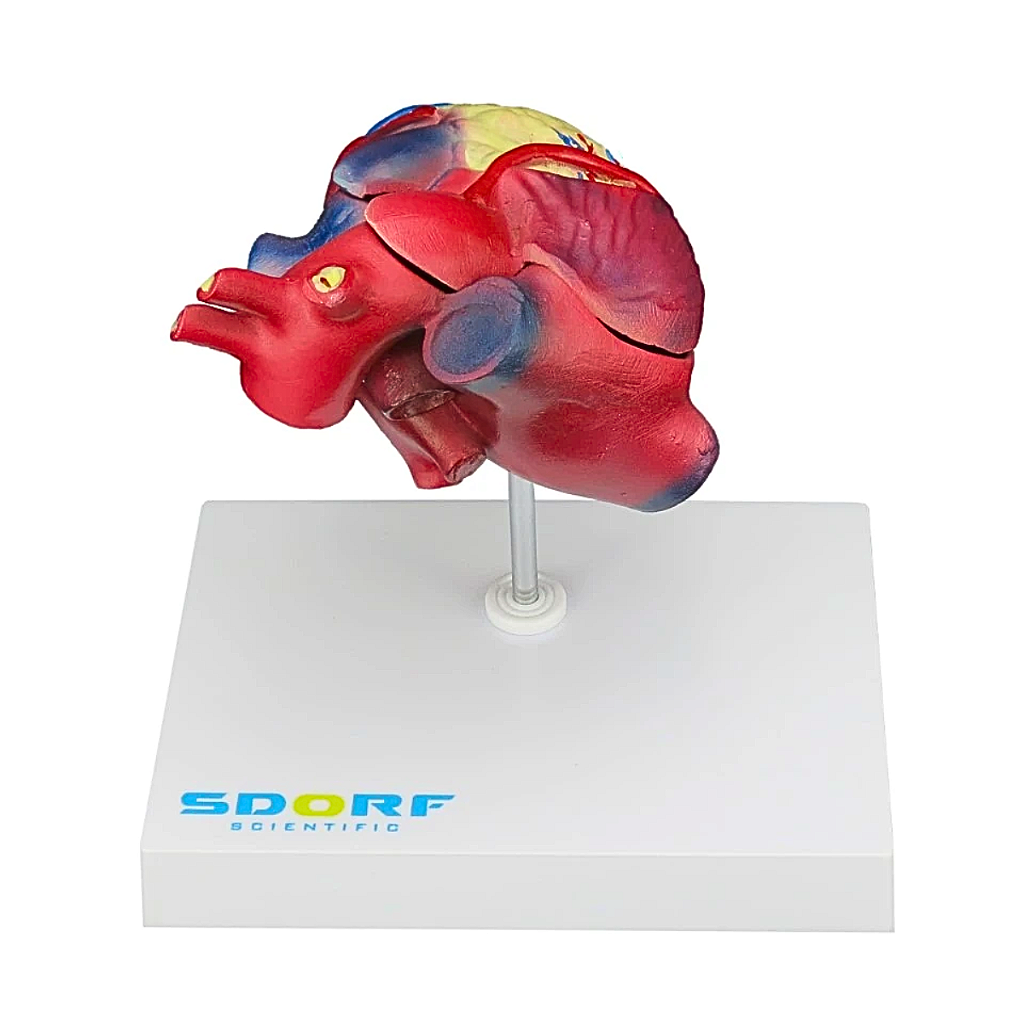 MODELO PATOLÓGICO DO CORAÇÃO COM HIPERTROFIA EM 2 PARTES - SD5214 - SDORF