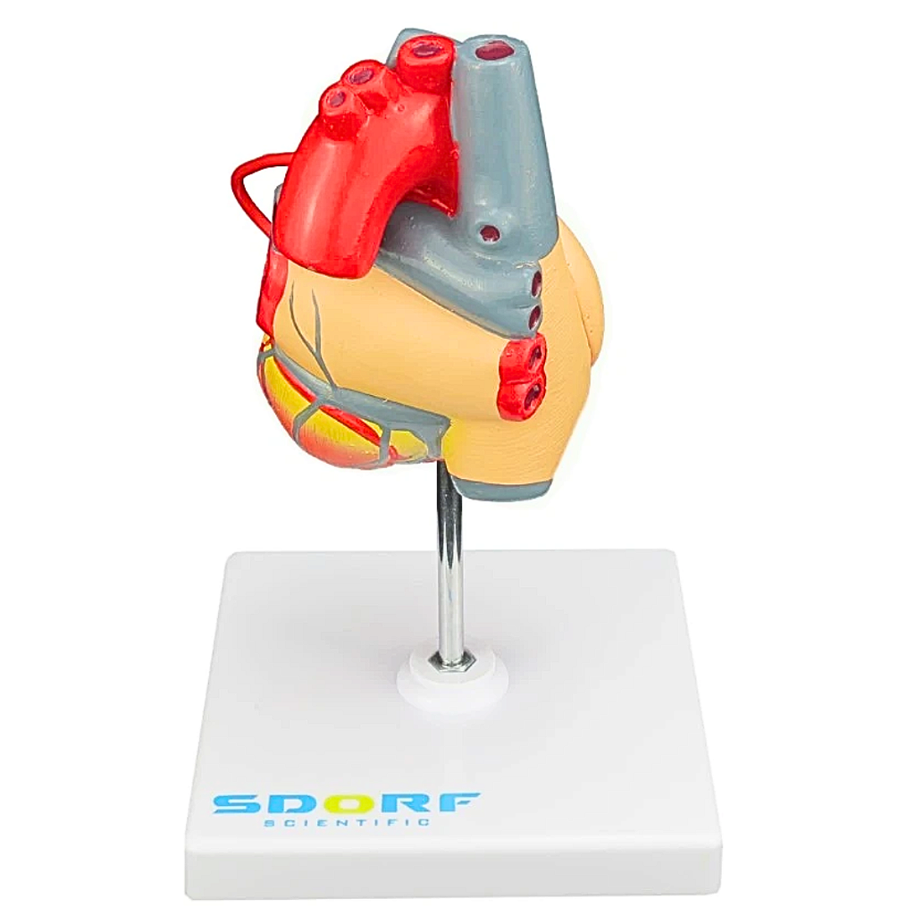 MODELO PATOLÓGICO DO CORAÇÃO COM PONTAGEM CORONÁRIA - SD5215 - SDORF